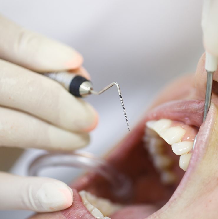 periodoncia