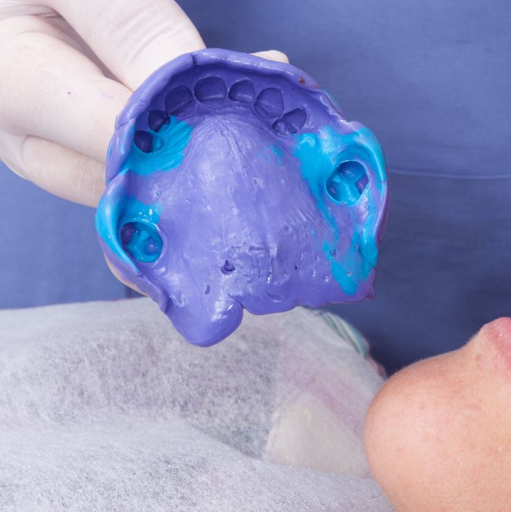 rehabilitacion oral